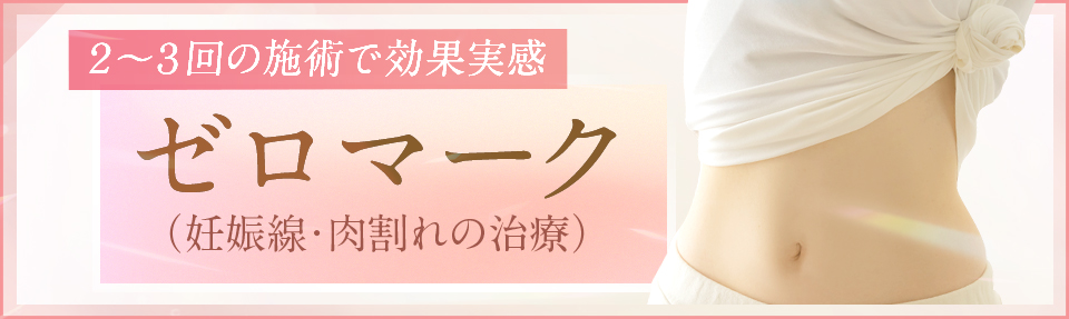 ゼロマーク