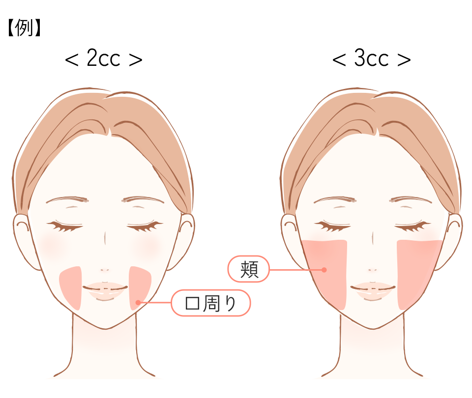 施術対応部位