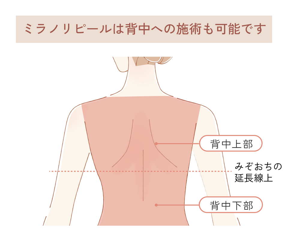 施術対応部位