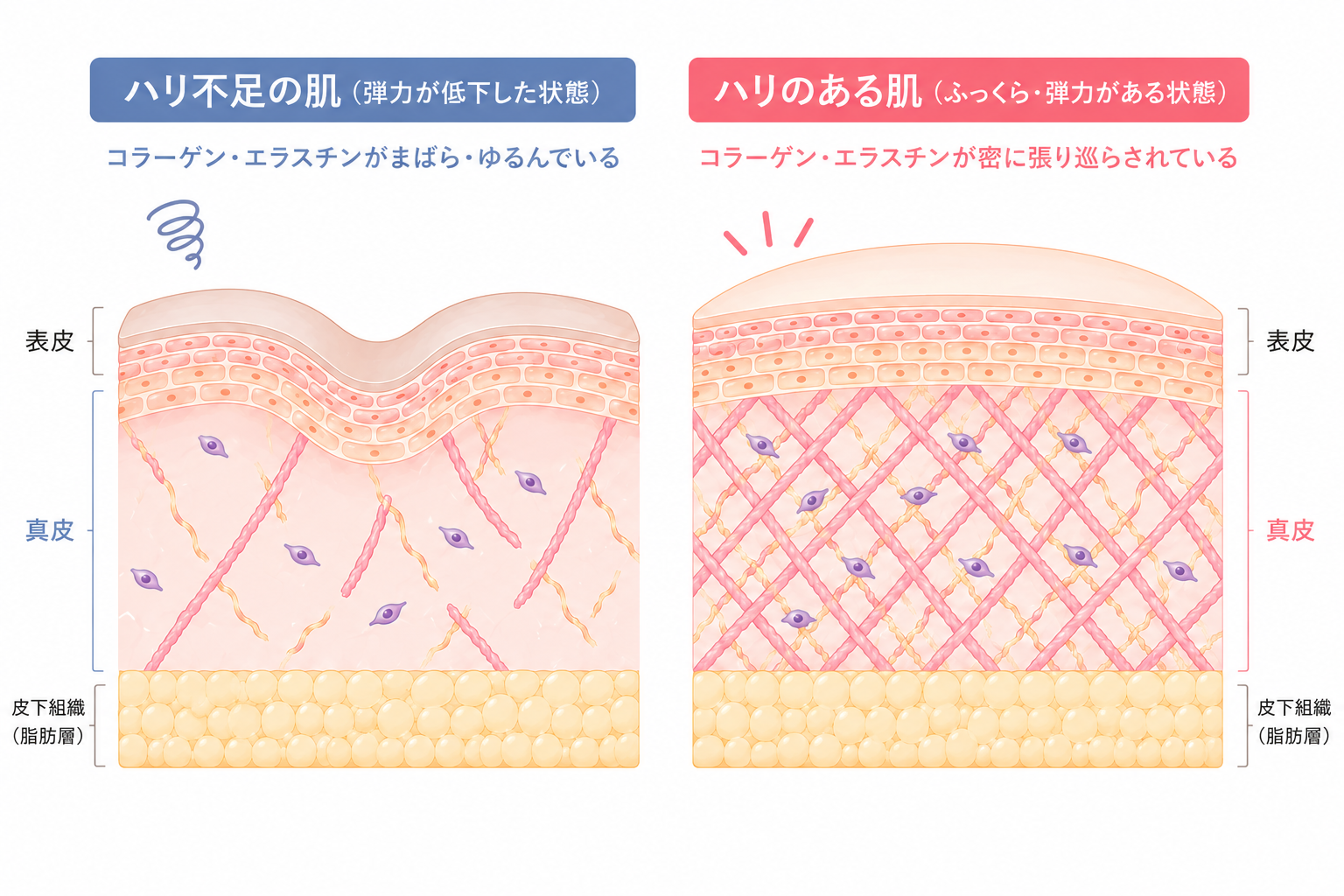 肌のハリ不足が老けて見える原因とは？